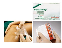 MEDICAZIONE STERILE IN FILM IN POLIURETANO TRASP. SUPRASORB F 10X12CM 10 PEZZI - farmachicca